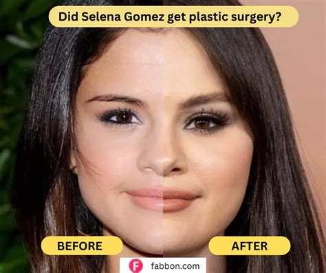 when did selena gomez boobs get so big|Selena Gomez Claps Back at Plastic Surgery。